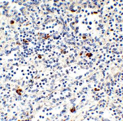 Immunohistochemistry-Paraffin: MNDA Antibody - BSA Free [NBP3-18135]